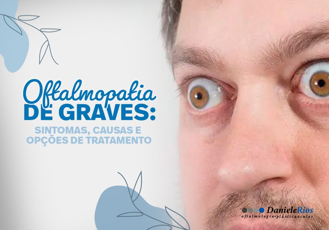 Oftalmopatia de Graves: sintomas, causas e opções de tratamento